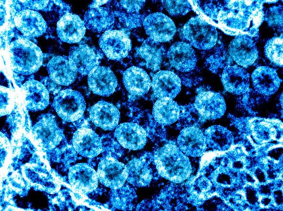 Transmission electron micrograph of SARS-CoV-2 virus particles, isolated from a patient. Photo: Flickr/