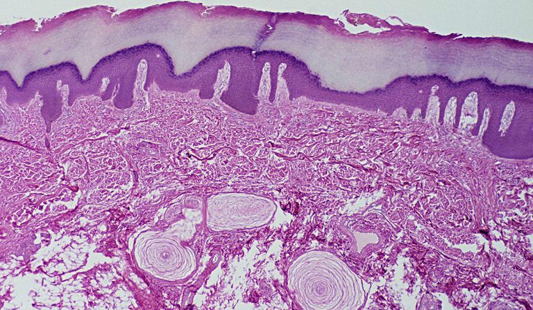 Digging deep: a close-up cross-section of the skin © Ed Reschke/Getty Images
