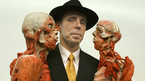 The man behind the scalpel: Gunther von Hagens. Image: Sion Touhig / Getty Images
